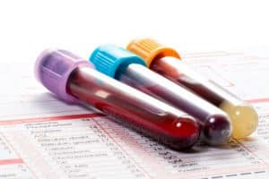 xDo Twins Have the Same Blood Type